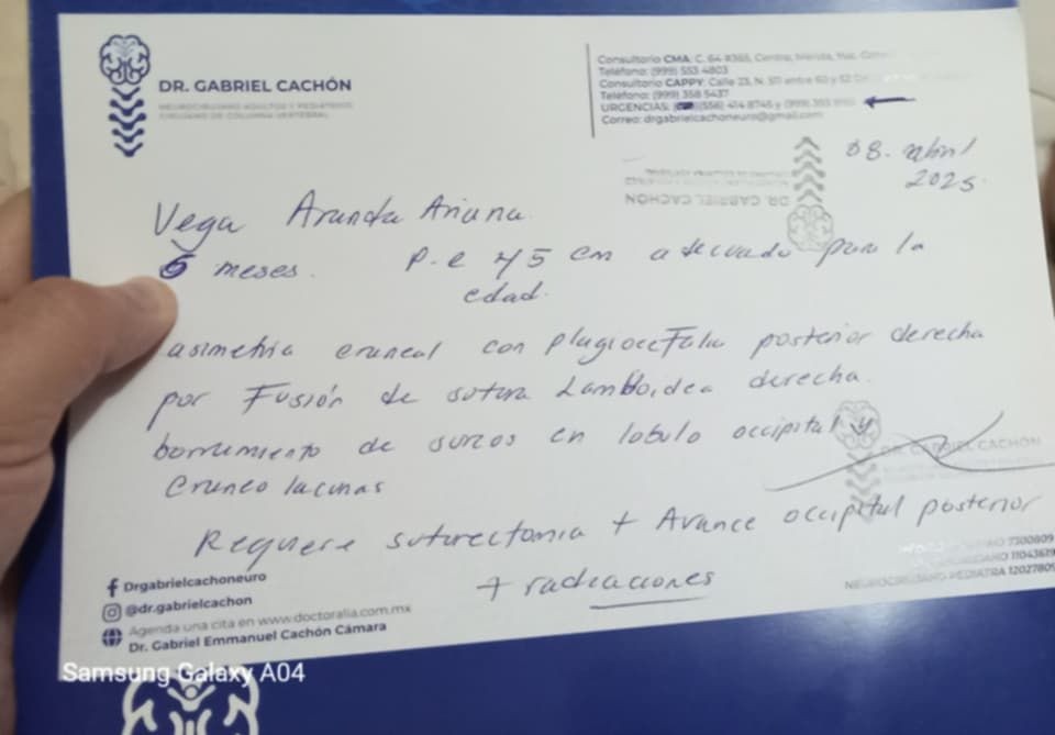 2 Recaudan fondos económicos para cirugía de niña de Panabá