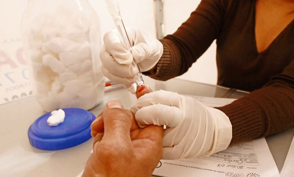 Yucatán mantiene el primer lugar nacional en casos de VIH