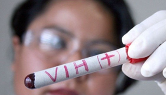 Yucatán entre los estados con más casos de VIH Yucatán entre los estados con más casos de VIH