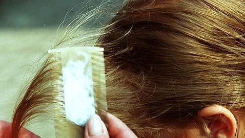Aún en temporada vacacional no se debe bajar la guardia para prevenir los piojos: IMSS Yucatán Aún en temporada vacacional no se debe bajar la guardia para prevenir los piojos: IMSS Yucatán