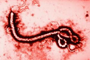 No hay ningún caso de Ébola detectado en México No hay ningún caso de Ébola detectado en México