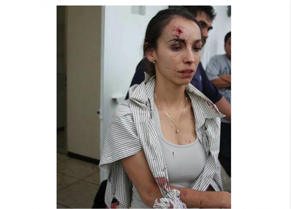 Por instrucciones del Alcalde golpean a una reportera Por instrucciones del Alcalde golpean a una reportera