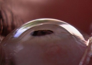 Recibio un transplante de cornea y espera tener una mejor calidad de vida Recibio un transplante de cornea y espera tener una mejor calidad de vida