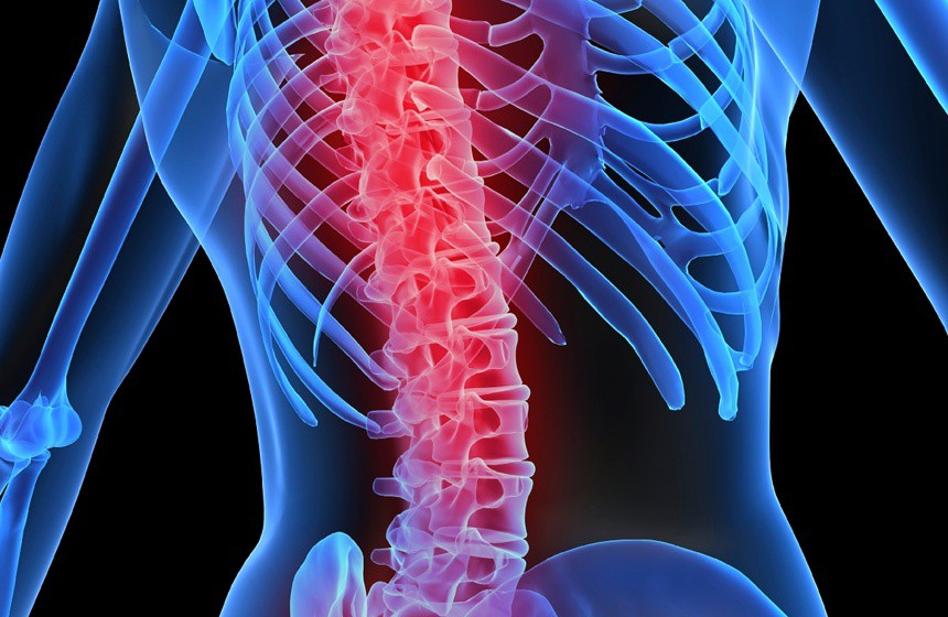 Una de cada 3 mujeres padecen osteoporosis Una de cada 3 mujeres padecen osteoporosis