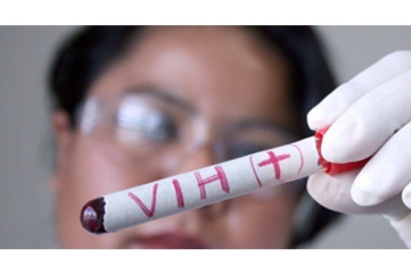 Realizaran foro sobre VIH-sida en Yucatán Realizaran foro sobre VIH-sida en Yucatán