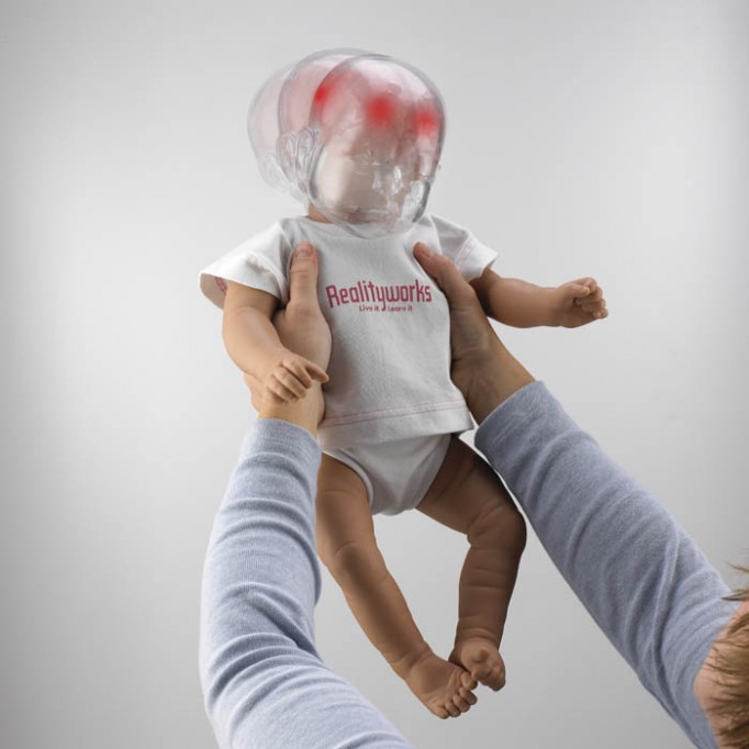Papás no conocen el Síndrome del niño sacudido Papás no conocen el Síndrome del niño sacudido