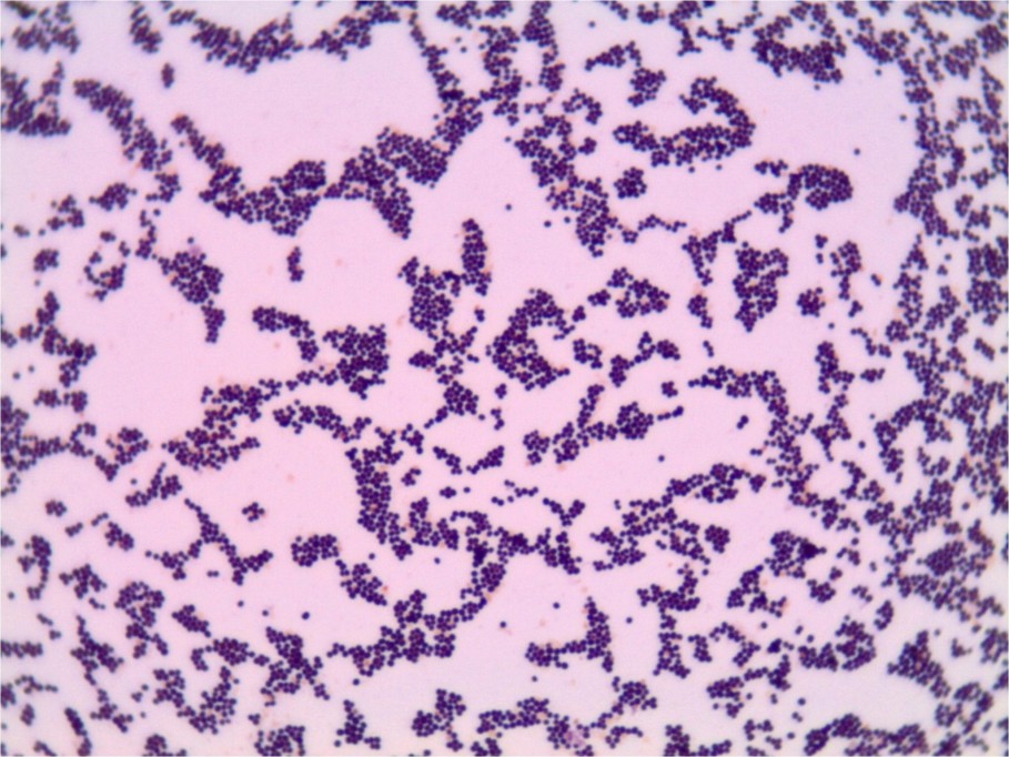 Familia campechana pudo contraer Staphilococcus aurius Familia campechana pudo contraer Staphilococcus aurius