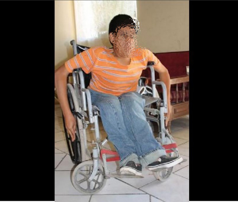 Joven con discapacidad pide ayuda para su operación Joven con discapacidad pide ayuda para su operación