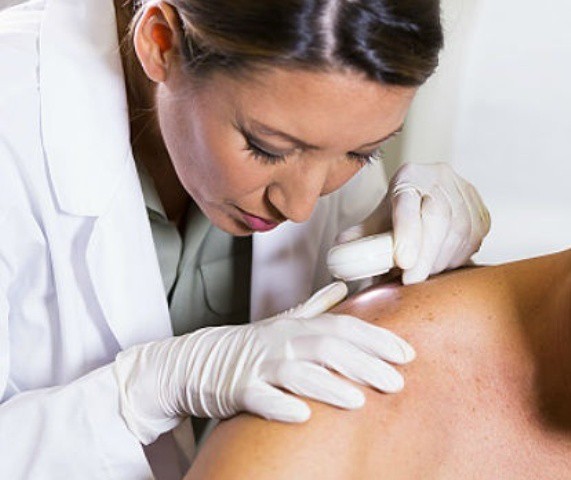 Realizarán jornada de detección de cáncer de piel Realizarán jornada de detección de cáncer de piel