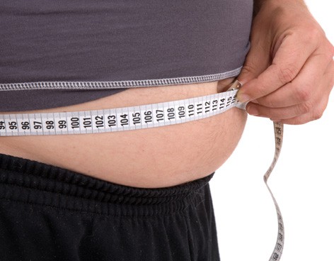 Yucatán sigue entre los 5 primeros lugares a nivel nacional en casos de obesidad Yucatán sigue entre los 5 primeros lugares a nivel nacional en casos de obesidad