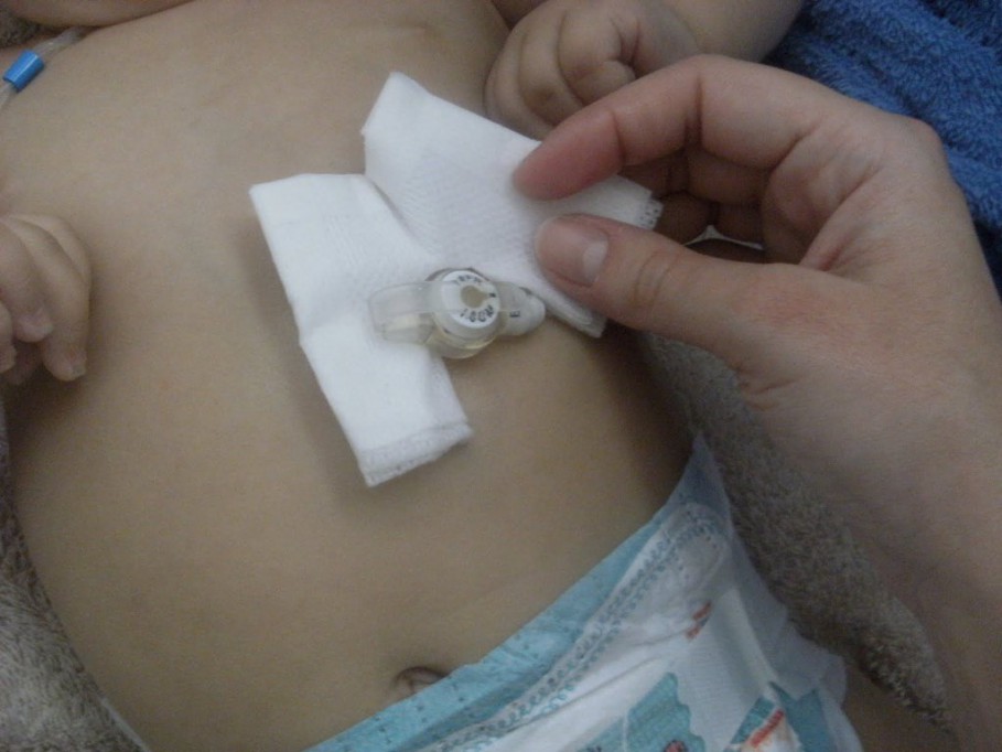 Pide ayuda para conseguir la sonda de su hija Pide ayuda para conseguir la sonda de su hija