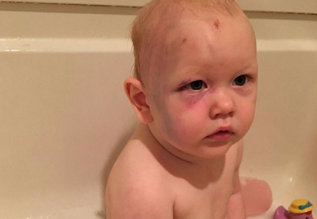 Exigen justicia para bebé golpeado Exigen justicia para bebé golpeado