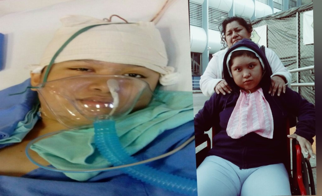 Solicitan ayuda para una joven con epilepsia Solicitan ayuda para una joven con epilepsia