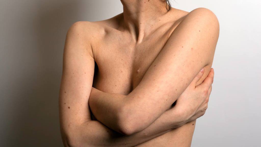 Mujeres indiferentes ante el cáncer de mama Mujeres indiferentes ante el cáncer de mama