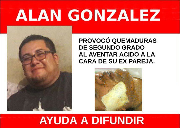 Quema la cara de su ex con ácido Quema la cara de su ex con ácido