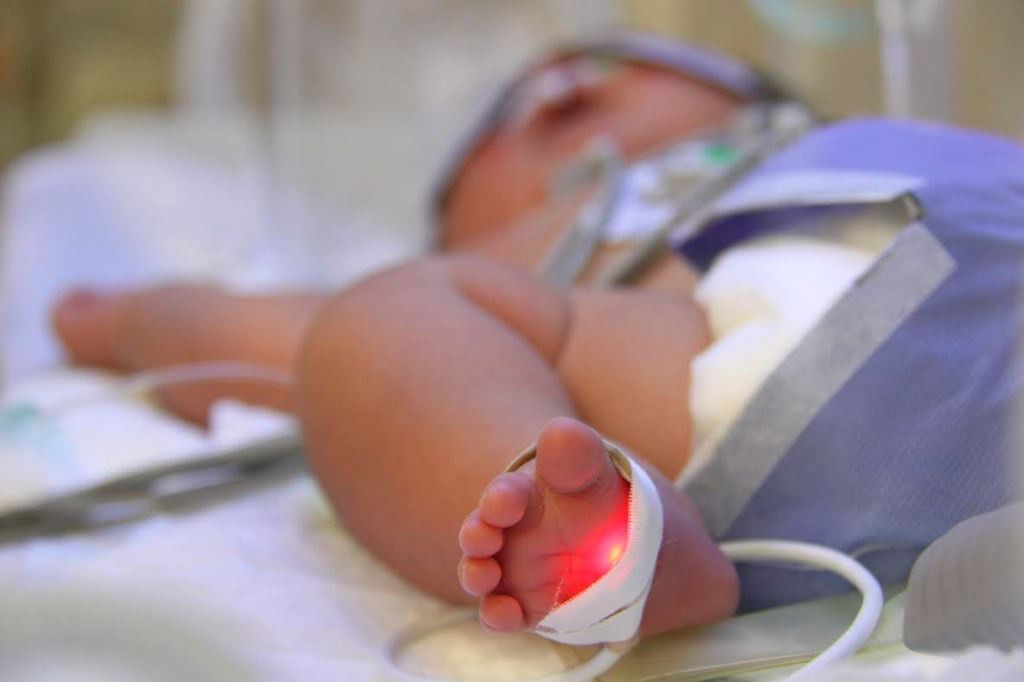 Realizan exitosa cirugía de corazón a un bebé en el IMSS Realizan exitosa cirugía de corazón a un bebé en el IMSS