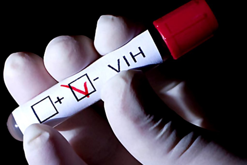 Hay más de 2 mil casos de VIH hay en Yucatán Hay más de 2 mil casos de VIH hay en Yucatán