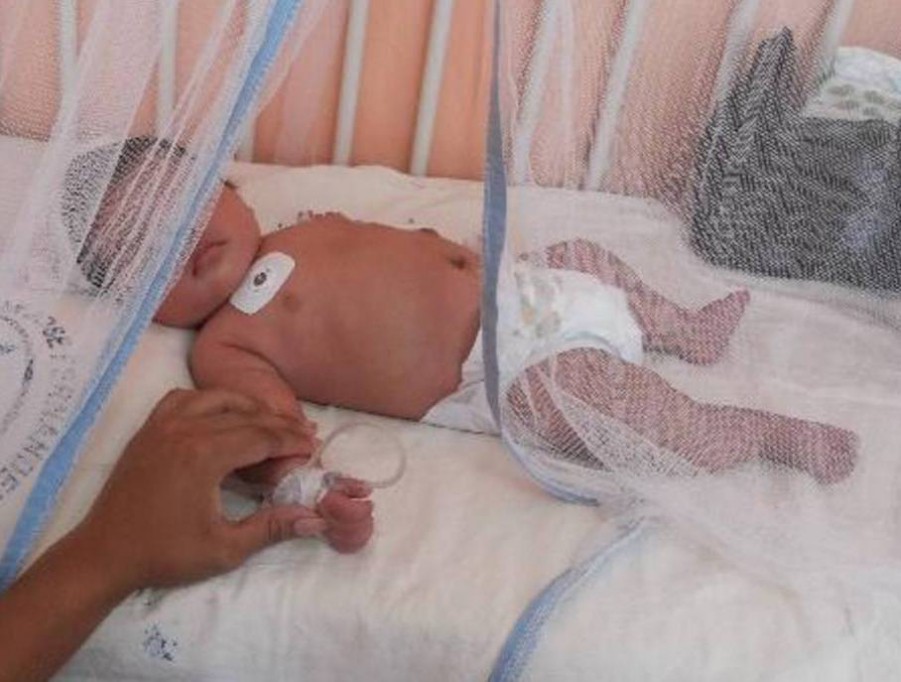 Pide ayuda para operar a su bebé de 9 meses Pide ayuda para operar a su bebé de 9 meses