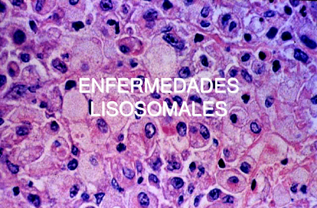 Mexicanos padecen enfermedades "raras" Mexicanos padecen enfermedades "raras"