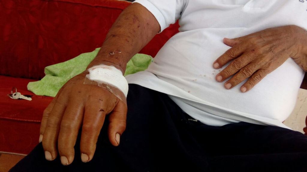 Mordió la mano que le da de comer Mordió la mano que le da de comer
