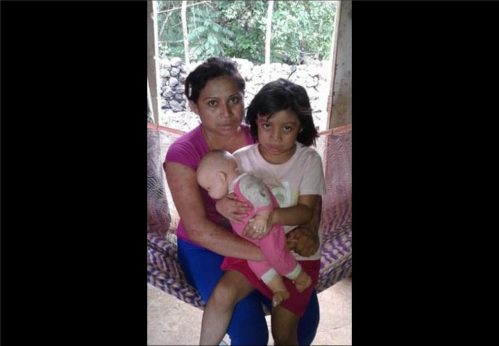 Piden ayuda para niña que padece convulsiones Piden ayuda para niña que padece convulsiones