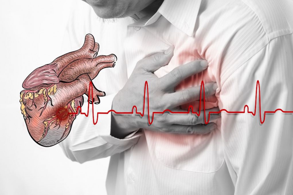 Enfermedades del corazón, el mal de los yucatecos Enfermedades del corazón, el mal de los yucatecos