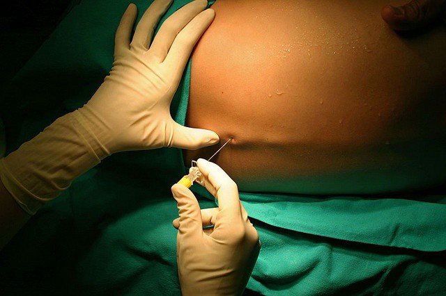 Mujer sufre por una mala inyección Mujer sufre por una mala inyección