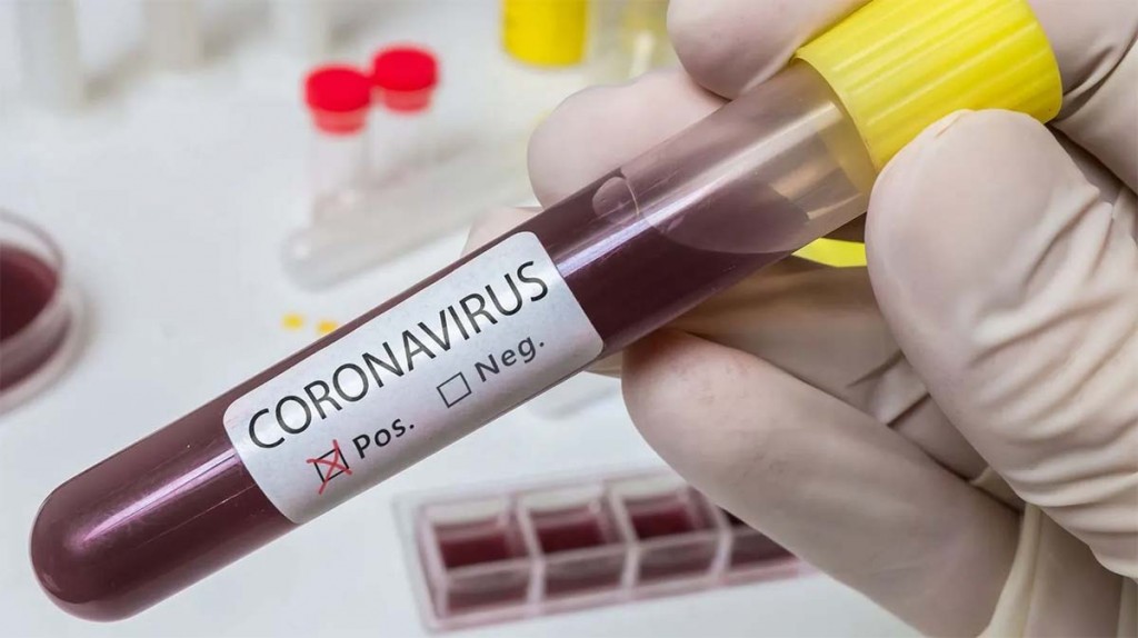 Reportan 69 nuevos casos de Covid en personal de Salud Reportan 69 nuevos casos de Covid en personal de Salud