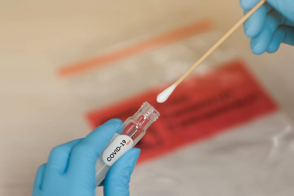 ¿Cuáles son las pruebas para detectar Covid-19? ¿Cuáles son las pruebas para detectar Covid-19?