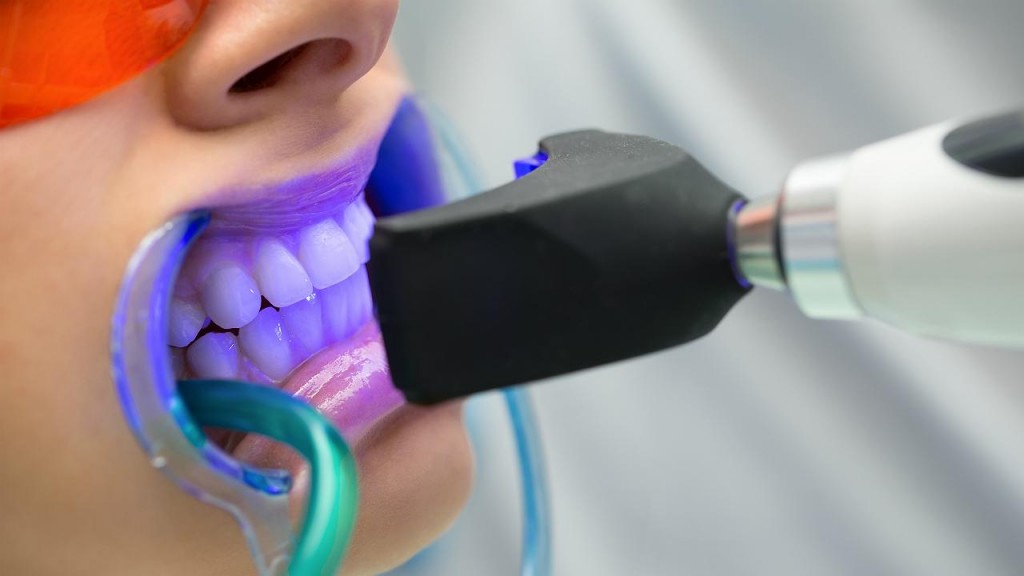 Aumenta la demanda del blanqueamiento dental Aumenta la demanda del blanqueamiento dental