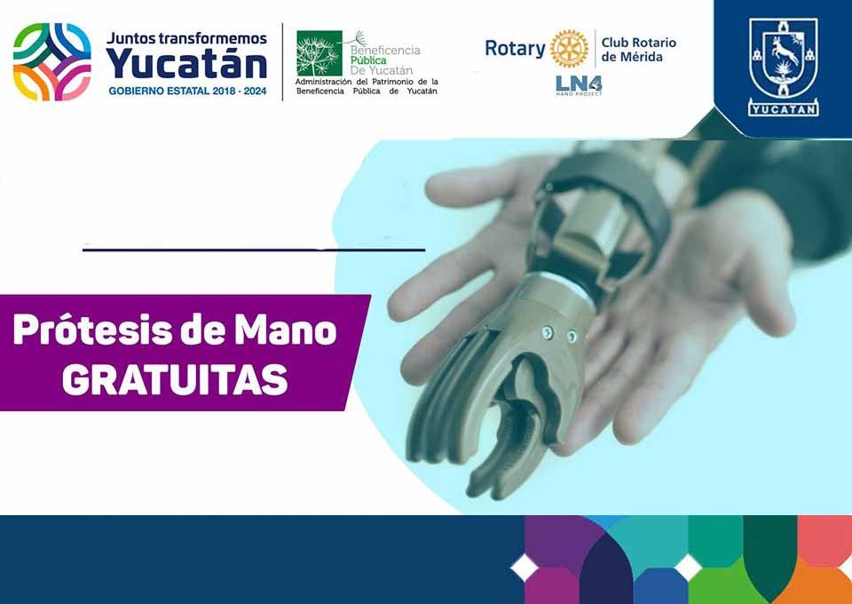 Club Rotario regalará 100 prótesis de mano en Yucatán Club Rotario regalará 100 prótesis de mano en Yucatán