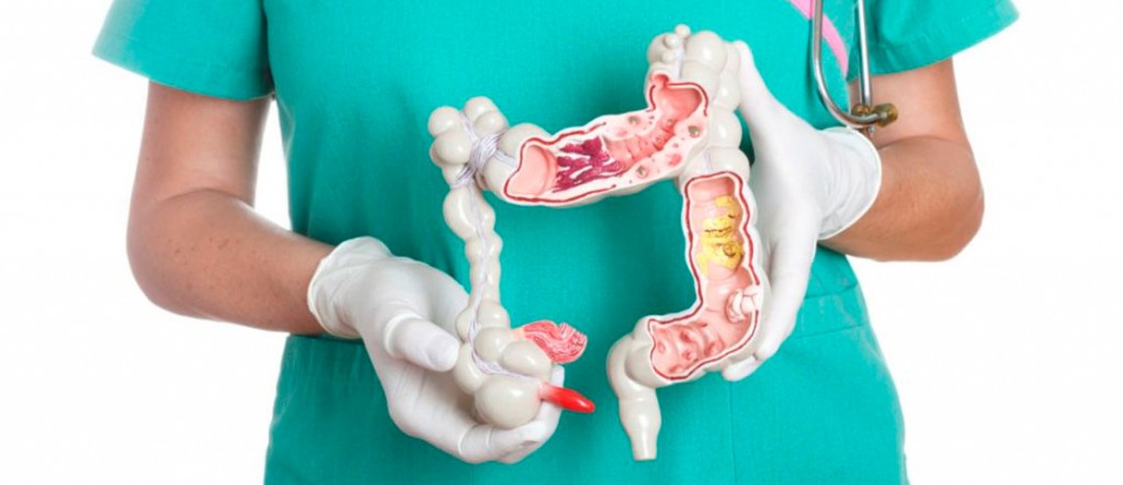 El cáncer colorrectal ya es el tercero más frecuente en todo el mundo El cáncer colorrectal ya es el tercero más frecuente en todo el mundo