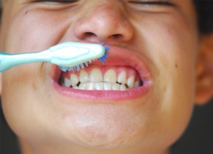 Yucatán primer lugar con menos caries infantil