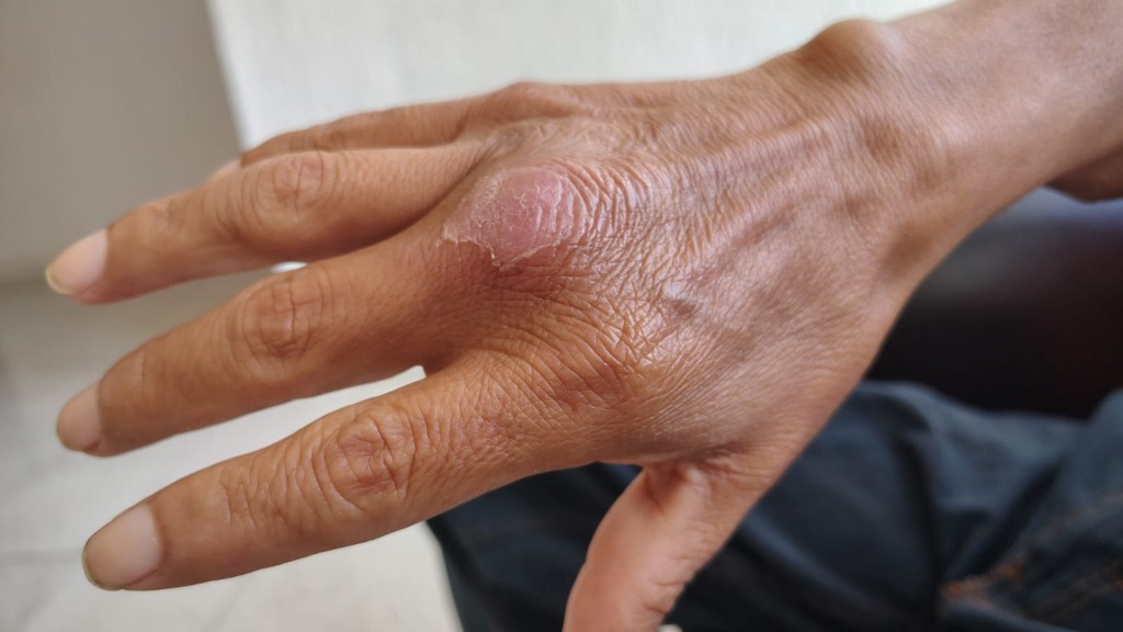 Requiere apoyo tizimileño para estudios médicos Requiere apoyo tizimileño para estudios médicos