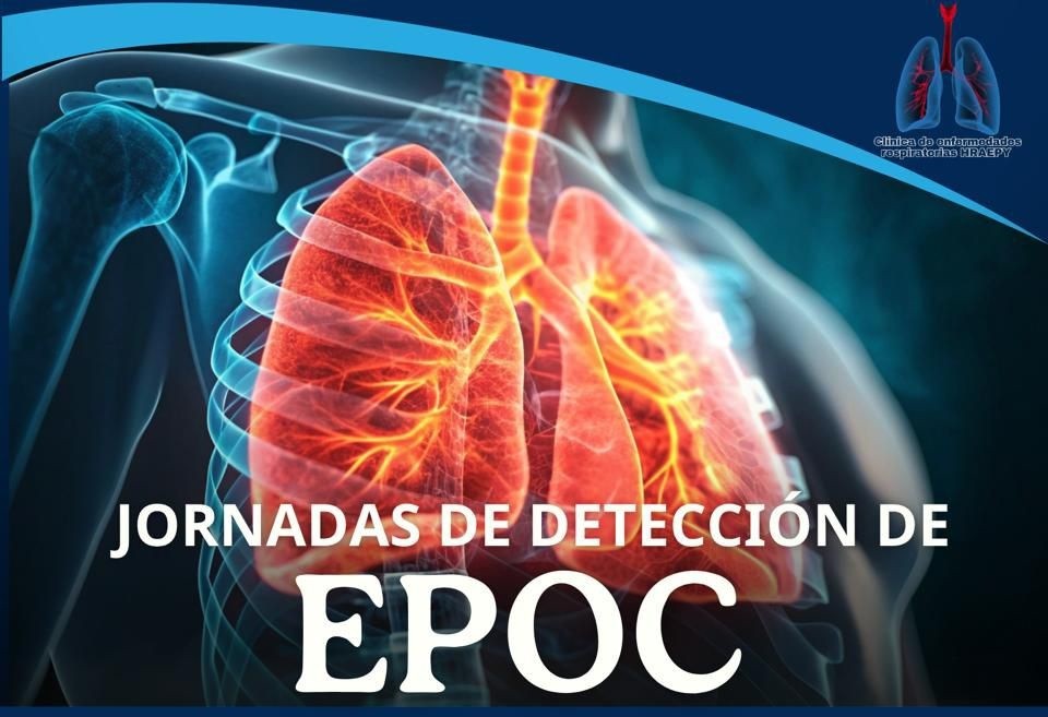 Anuncian Jornadas gratuitas de detección de EPOC