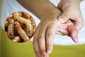 Registran 16 casos de gusano barrenador en humanos